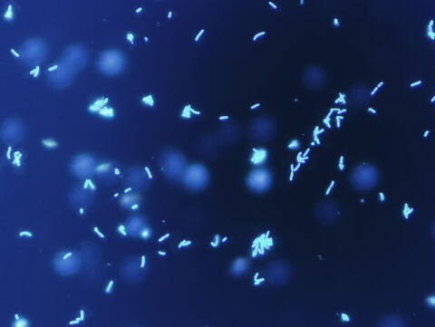 ゲノムが小さくなっていく現象に新説【OISTレポート】